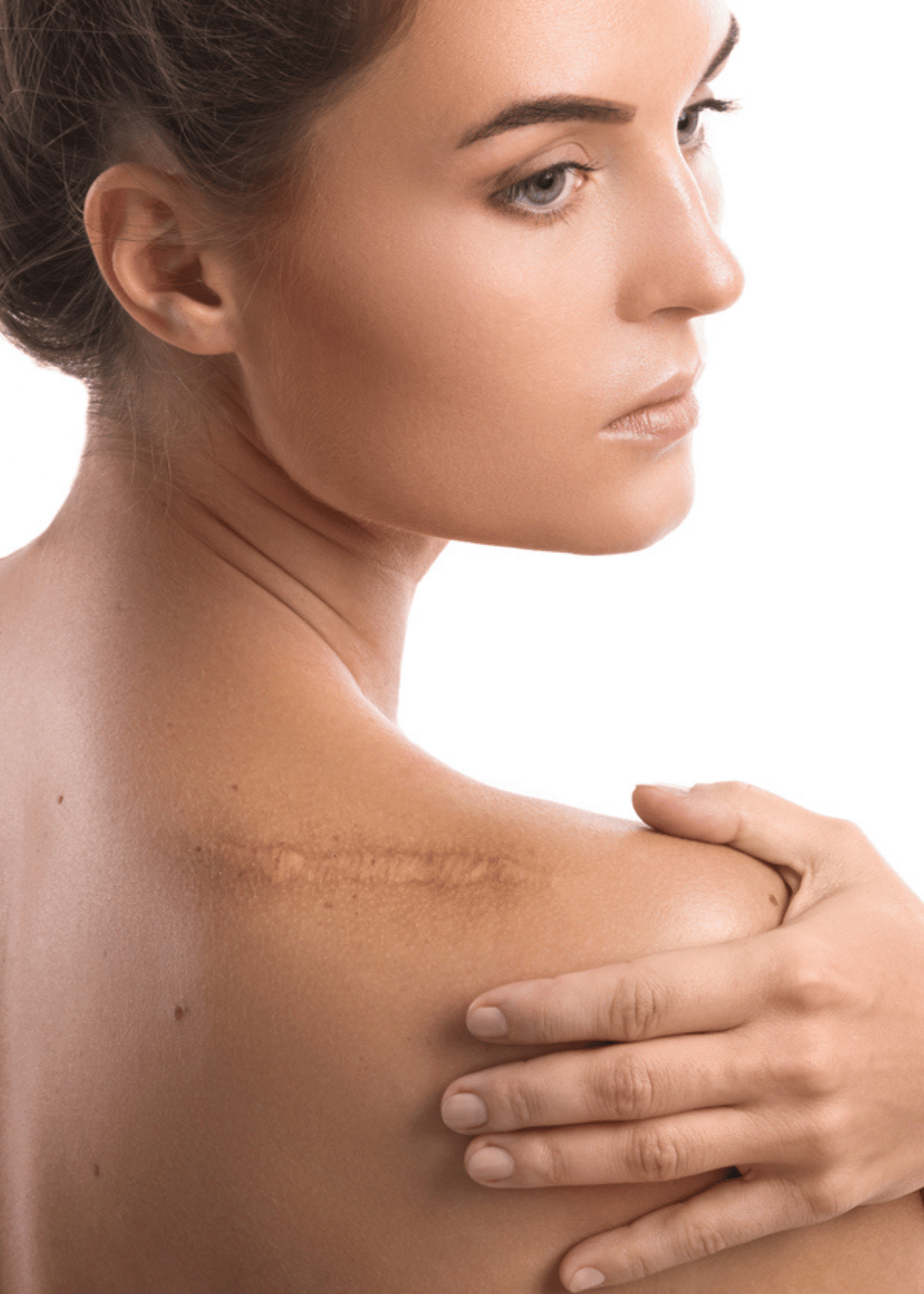 Best Silicone Gel For Scars